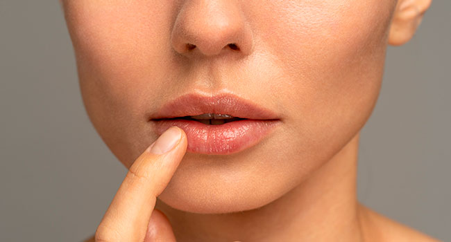 tratamientos acido hialuronico labios y arrugas madrid